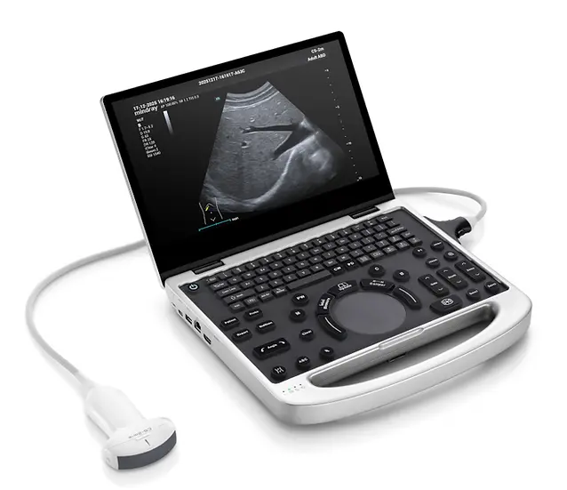 Tragbares Ultraschallsystem MU7